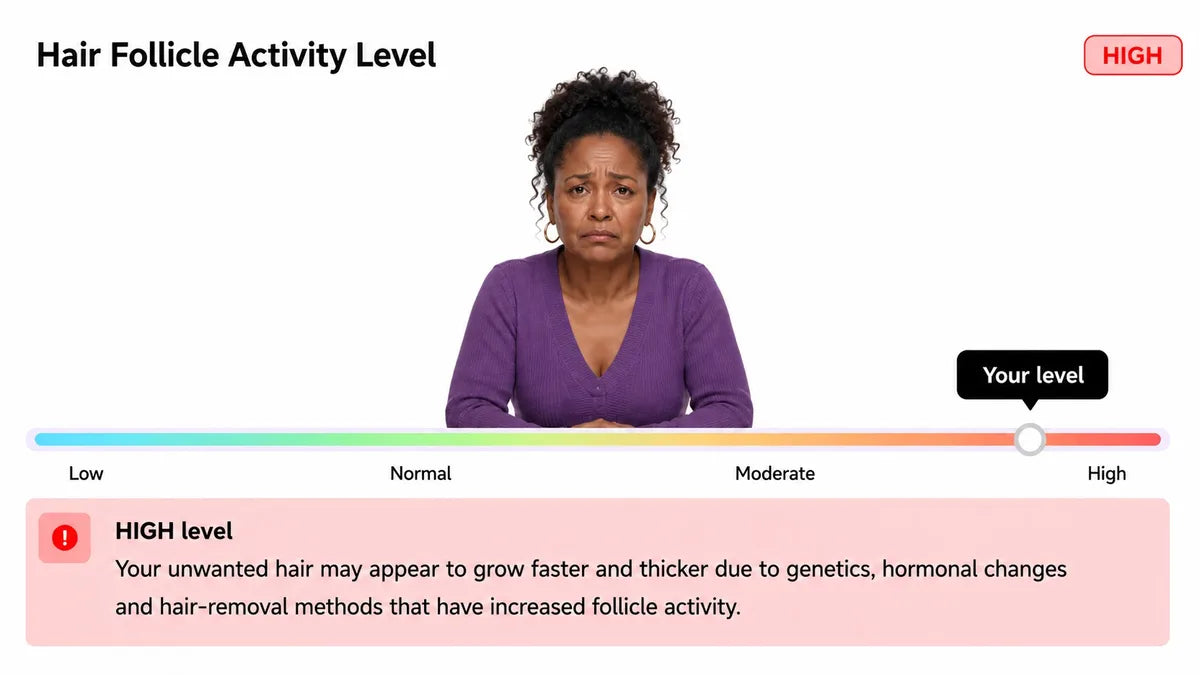 Hair follicle activity level: high